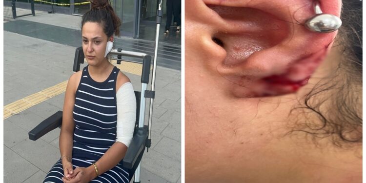 Gazeteciye saldırı